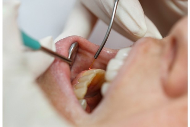 12. What is Laser Dentistry1