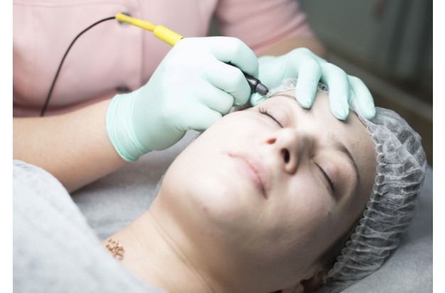 14. electrolysis vs laser hair removal1