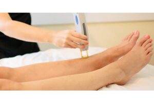 11. How to Prepare for Laser Hair Removal1